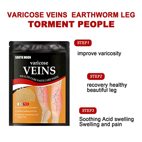 Tratamento de adesivo de veias varicose para as pernas Varicações de veias de veias de veias de veias de veias
