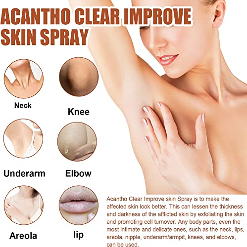 Acantho Clear Therapy Spray, Acanthosis Nigricans Therapy Spray-A01