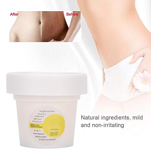 Creme de estrias, creme de cicatriz para obesidade pós -parto, ferramenta de reparo de pele para tratamento pós -parto, remover cicatrizes hidratantes e clareamento