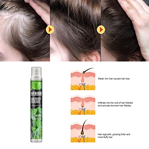 Essência de crescimento de ervas Spray spray soro anti-perda de cabelo cresça rápido, evita a essência do crescimento de cabelos,