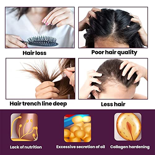 Dashenran Kera'gro-revive shampoo de espuma, shampoo de espuma de cabelo Keragro, biotina e shampoo de colágeno shampoo de crescimento