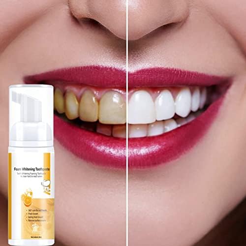 Lavagem aquática de dentes de limpeza de dentes de fruta de dente de dente fresco sujeira de dente 50ml a seleção de água