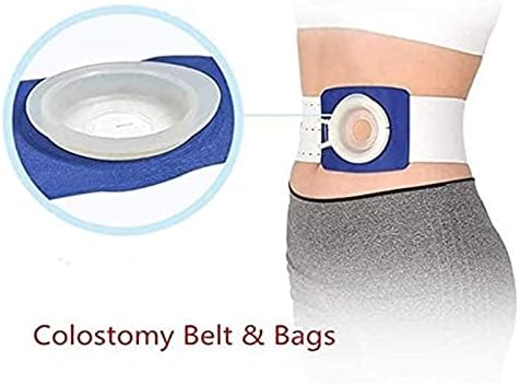 Cinturão de ostomia abdominal, pós -colostomia estoma de bandagem e traseiro suportam cintos de estoma respirável suprimento de pele