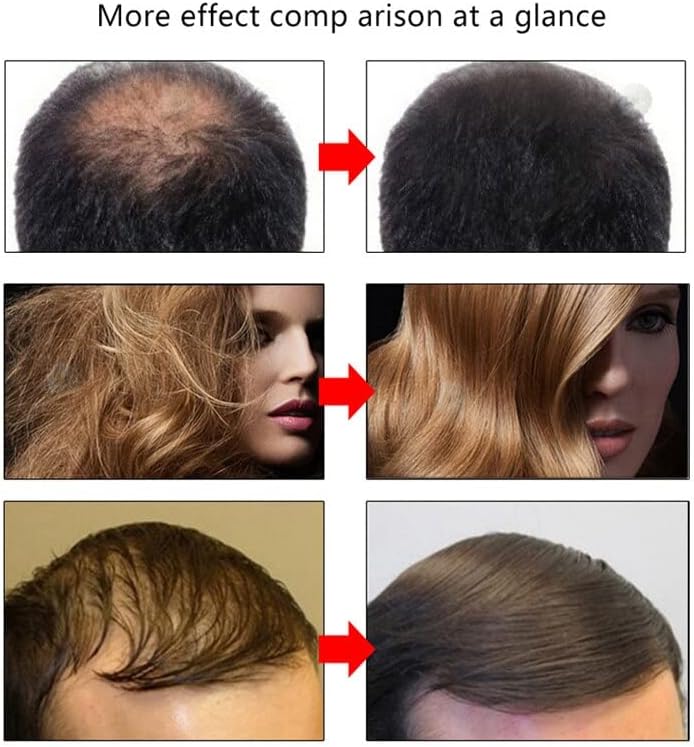 Crescimento do cabelo para o cabelo de óleo essencial para perda de cabelo Produtos de tratamento rápido Reparo de cabelos