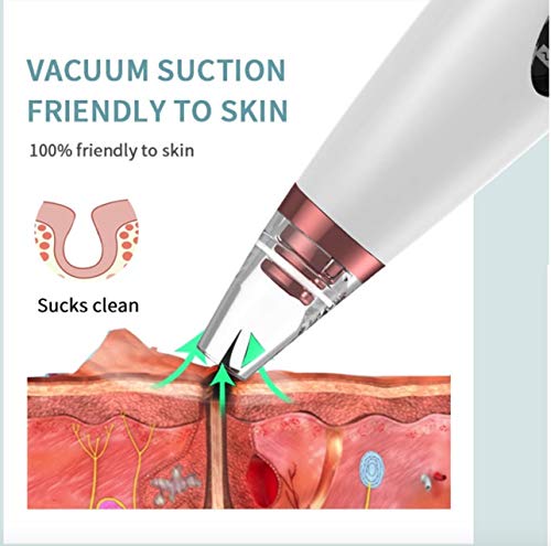 Ferramenta de remoção de espinha com extração de cravo de cravo facial a vácuo