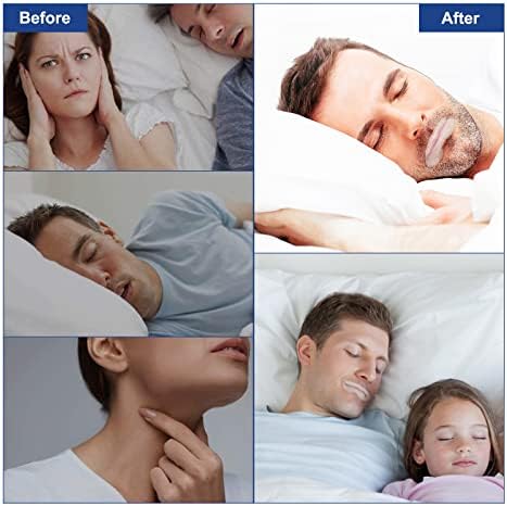 90 PCs Fita de boca, fita bucal para dormir, tiras anti -ronco para as tiras bucais respiratórias nasais para respiração nasal, melhorar a qualidade do sono e instantâneos de alívio do sono
