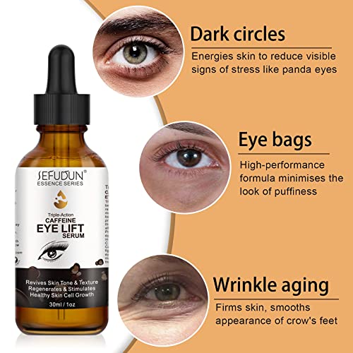 Soro ocular de cafeína, soro ocular anti -envelhecimento rugas desaparece efetivamente círculos escuros, sacos oculares, ajudando a minimizar as rugas e linhas finas, eliminar o inchaço, com EGCG, vitamina C em soro ocular 30ml