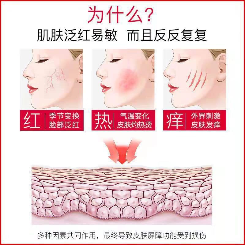 O creme de cuidados especiais de Yiylunneo hidrata a pele, refresca e absorve facilmente, repara a pele sensível, o creme hidratante,