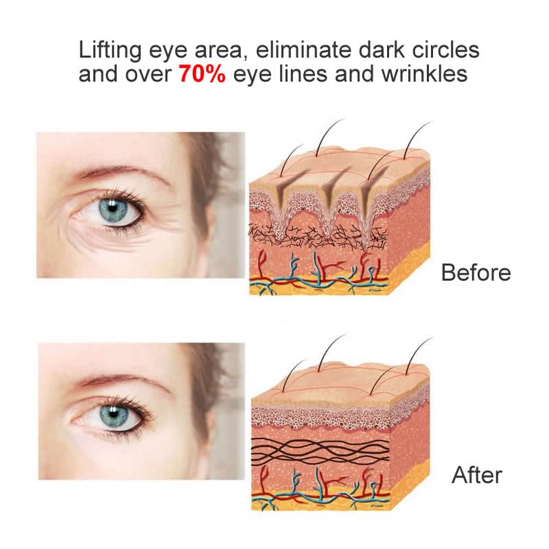 Eye Sore Anti-Dark Circle Anti-Puffiness Hidratante Massagem Cuidados Olhos 10ml