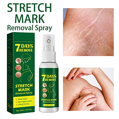 Remoção de estrias Spray Spray Stretchs Belly Wrinkles