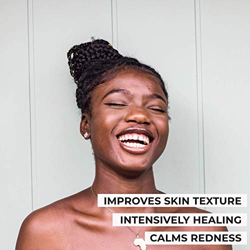 O Naturals Organic African Black Soap Bar 3pc - Rico em manteiga de karité africana - ajuda a pele propensa a acne - lavagem natural do corpo e lavagem do rosto - sabão preto africano - barra de sabão preto natural para mulheres e homens