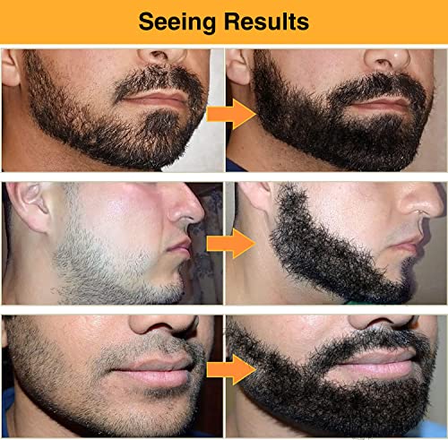 Kit de barba por caneta de barba mishich para homens