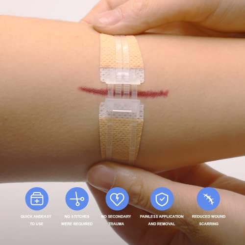 Bandagens adesivas LUBYD FDA Fechamentos de laceração de emergência liberados - Reparação de feridas sem pontos para ferida de 1/2-3 de 1/4 de polegada. Fazinho flexível à prova de água