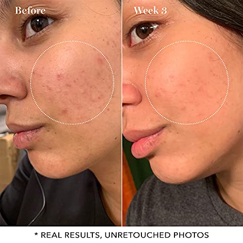 Sábado Skin Pore Toner esclarecedor 10% de ácido glicólico e aha de limpeza profunda e tratamento ativo sérico de poros para face