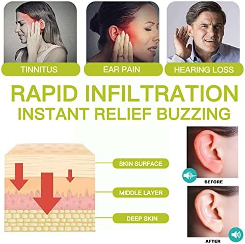 Alívio do zumbido para manchas de orelhas, ninitus naturais de alívio de alívio para a perda auditiva e alívio da dor no ouvido alivia