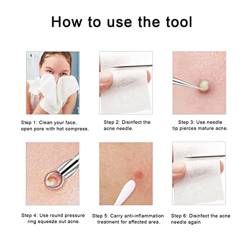 Fix Bodyhead Blackhead & Splinter Remover Tools - Profissional de aço inoxidável curar facilmente espinhas Whiteheads comedonas acne