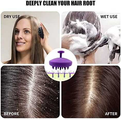 Escova de shampoo de cabelo, [2 pacote] escova de shampoo de couro cabeludo com massageador de cabeça manual de silicone