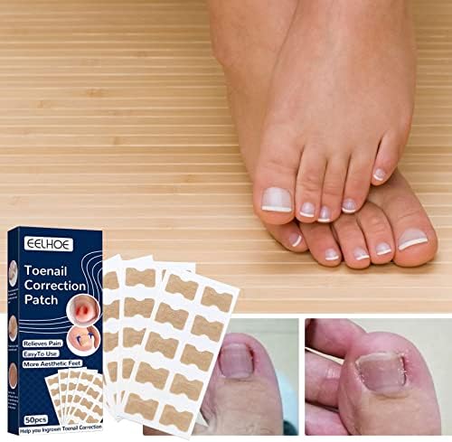 Pedicure Stone 50 peças de remendo elástico Curvadas da unha de suporte Manicure Starters unhas Correção de unhas Pature unhas