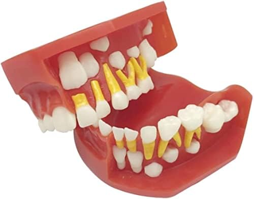 Modelo de ensino, dentes decíduos removíveis Modelo Dental Crianças odontológicas Anatomia humana Modelo - Exibição