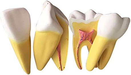 Modelo odontológico KH66ZKY Aumentado Surface Granule Pulp Modelo Oral do Modelo Oral do Modelo Oral